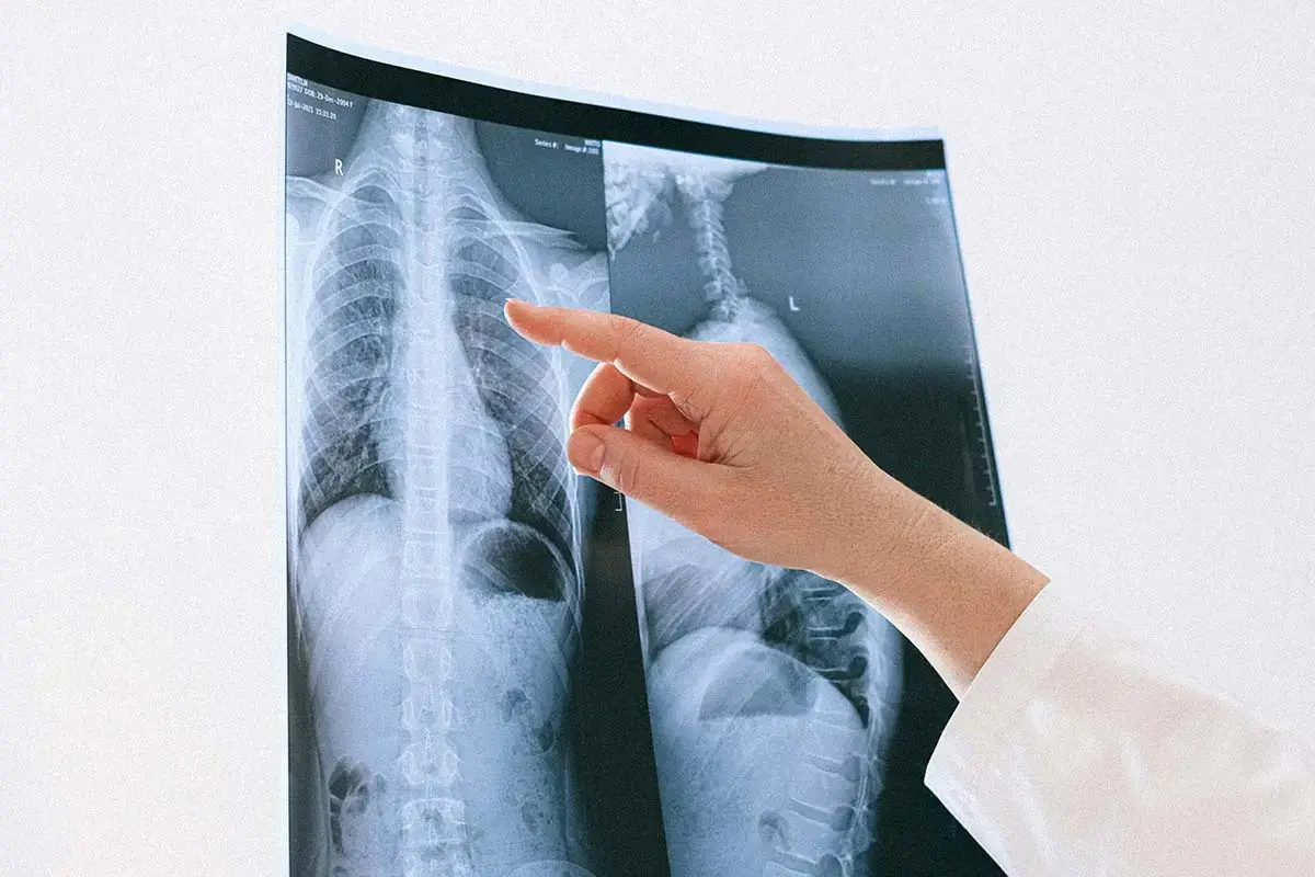 Barbaro fisioterapia valutazione posturale