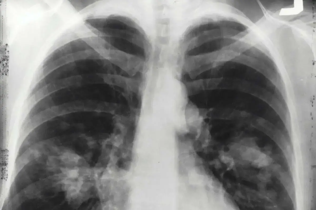 Barbaro fisioterapia analisi cardiologica